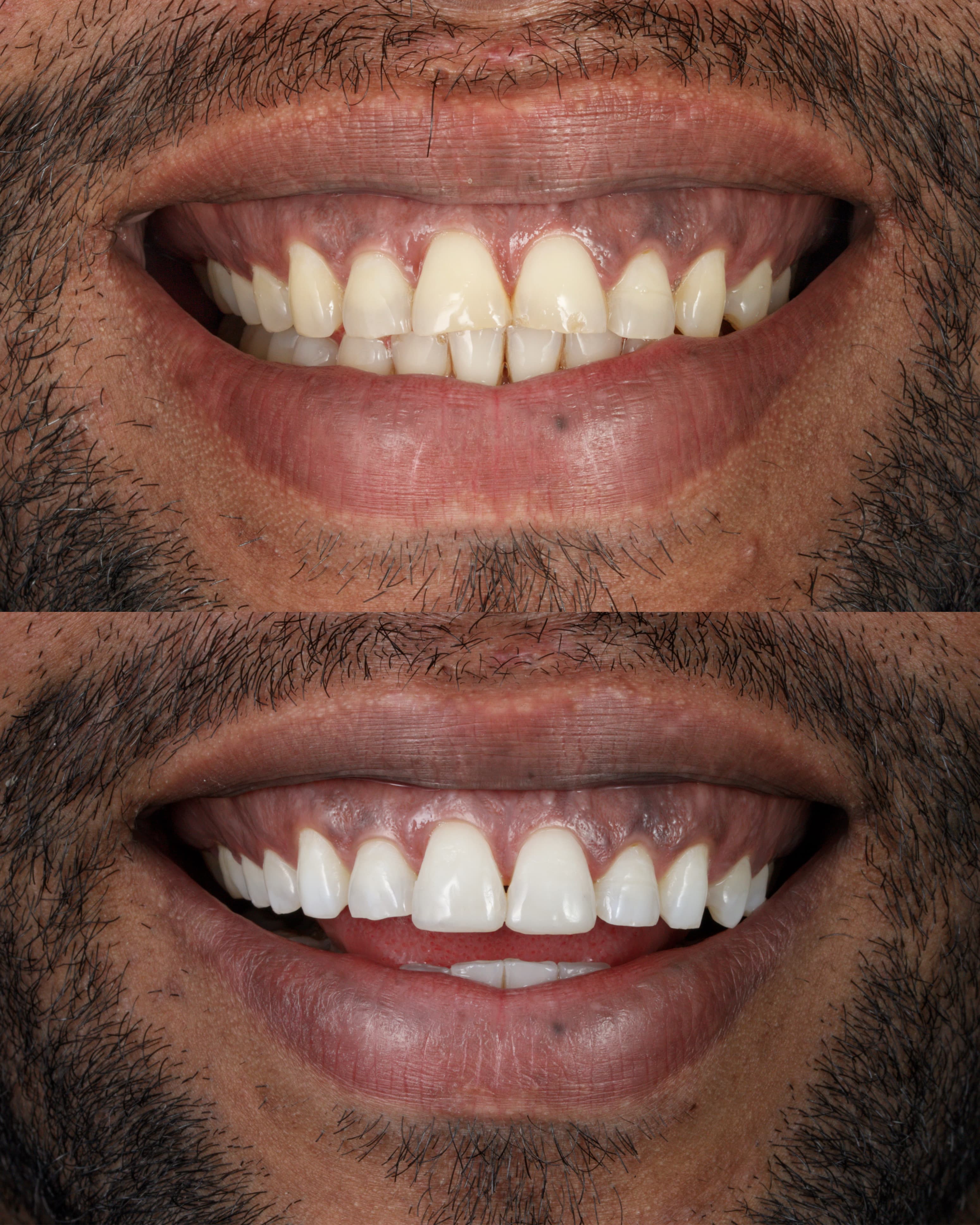 Planejamento Digital 3D - Foto 1