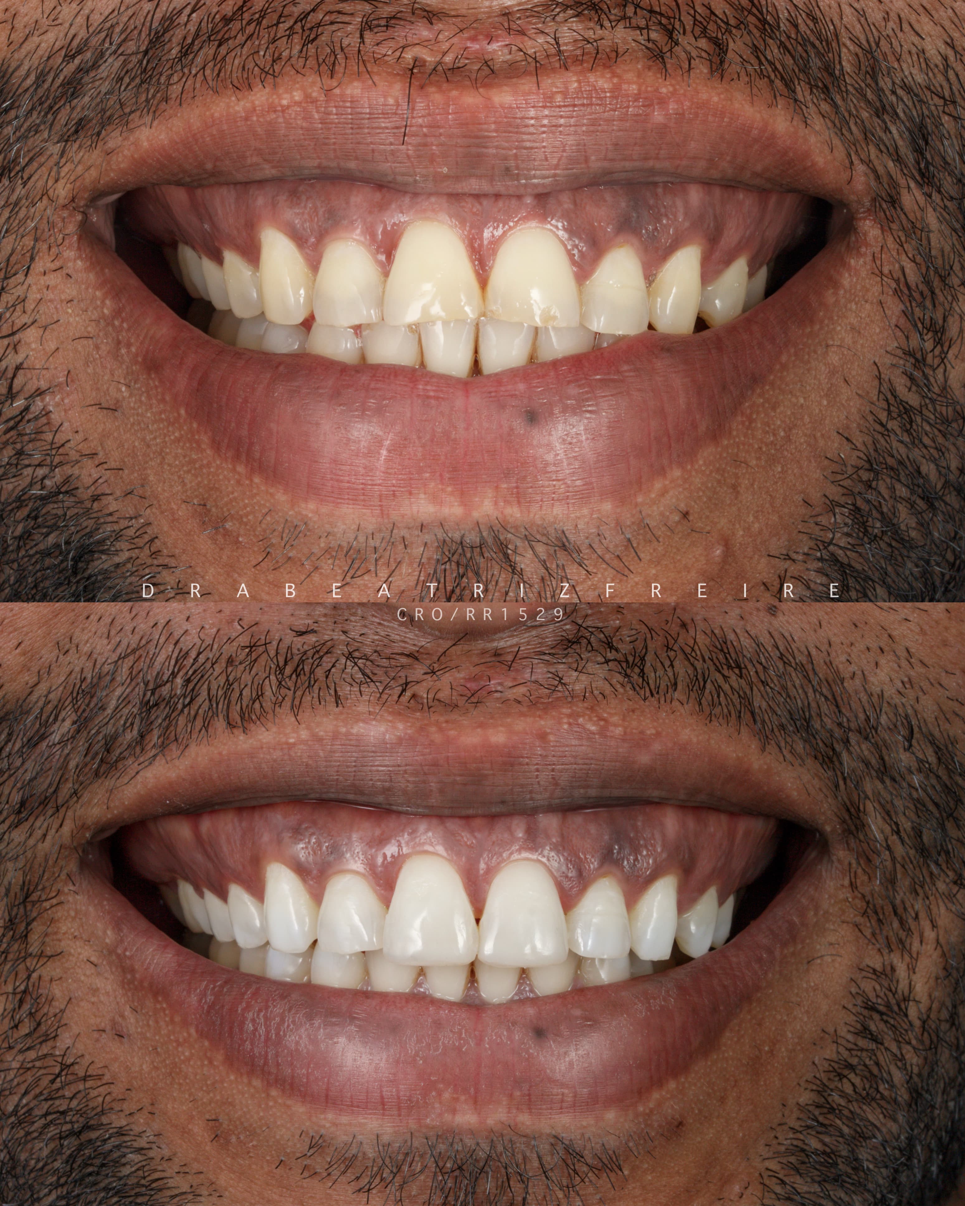 Planejamento Digital 3D - Foto 3