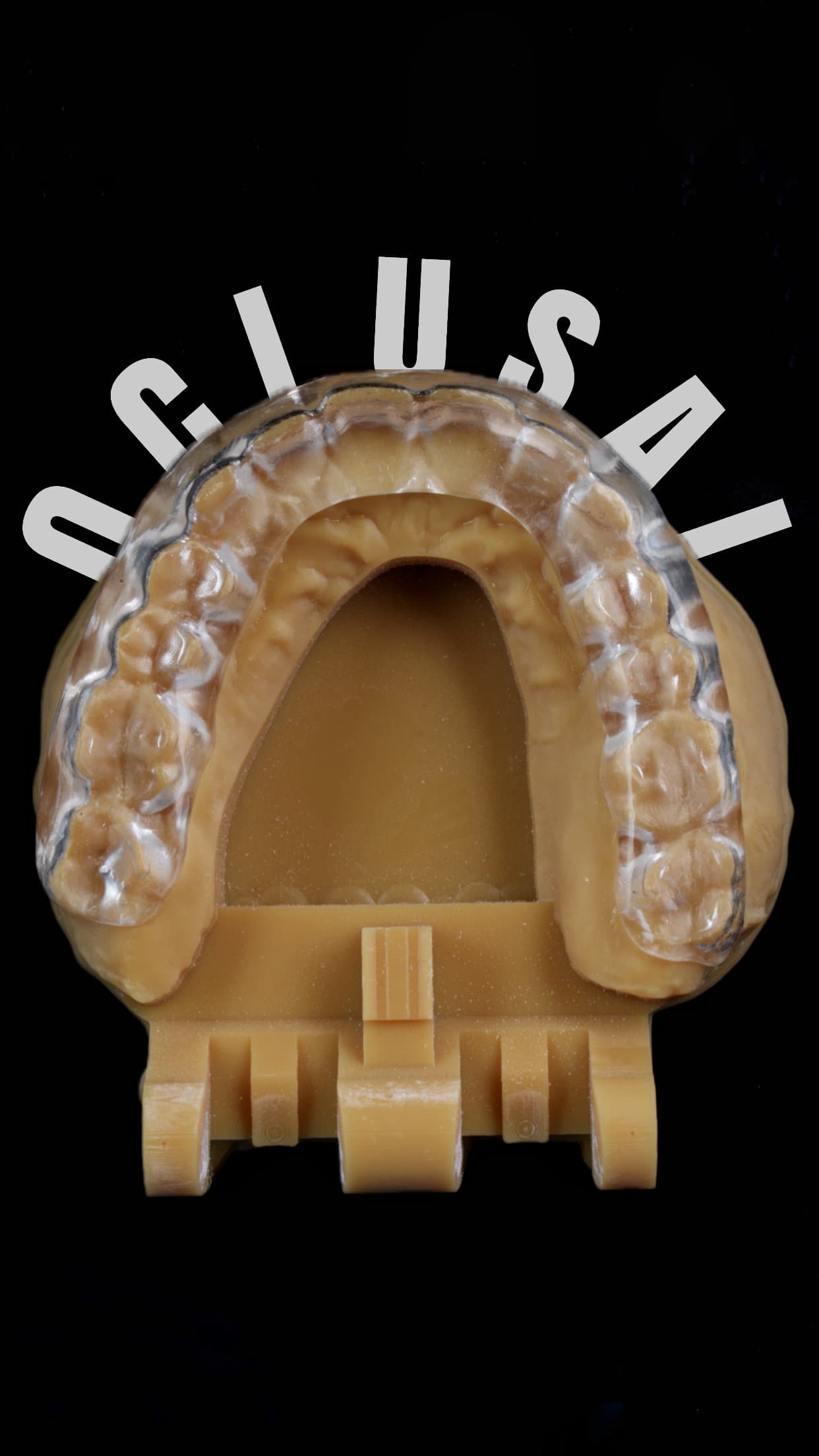 Controle do Bruxismo - Foto 2