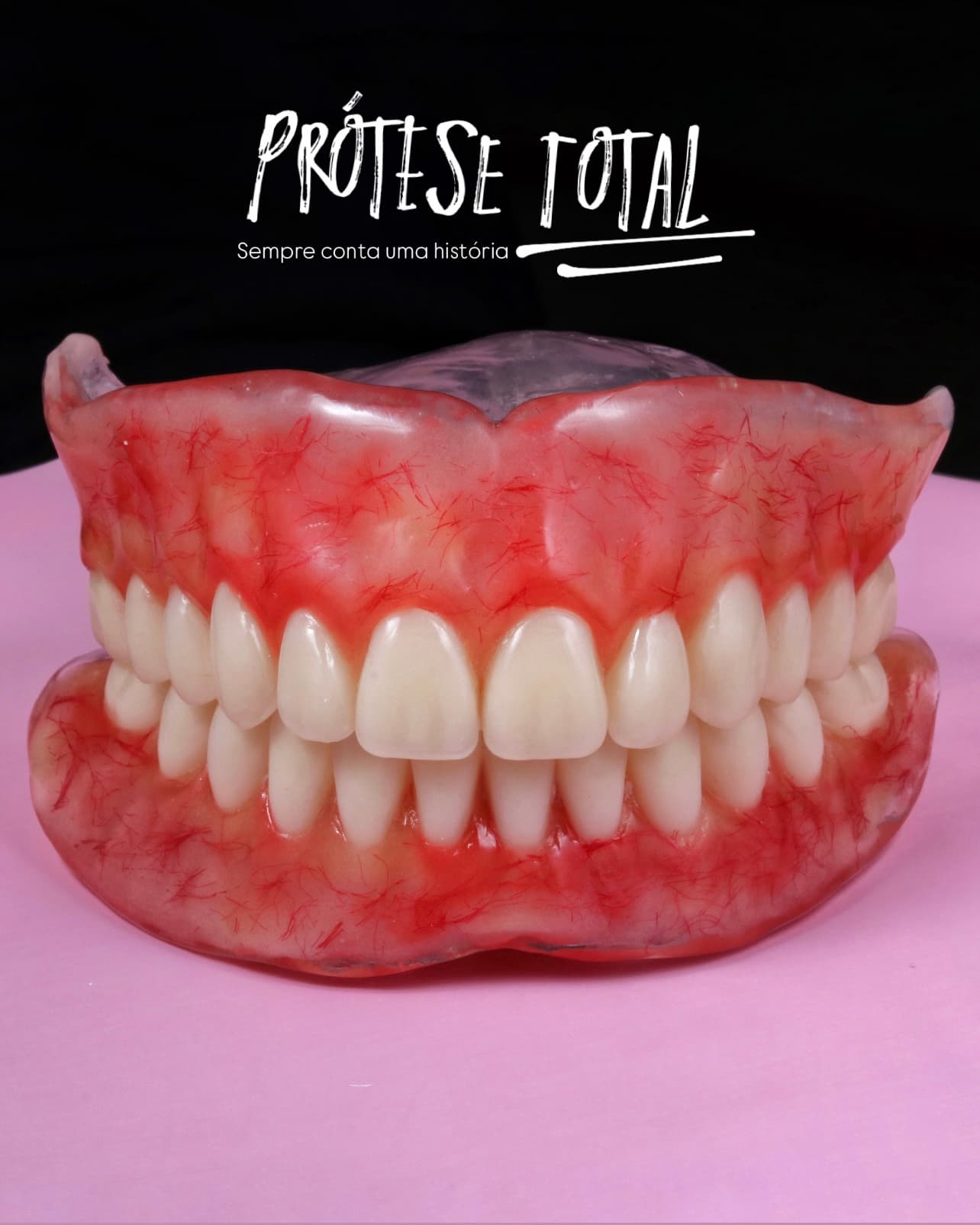 Prótese Total Caracterizada - Foto 1