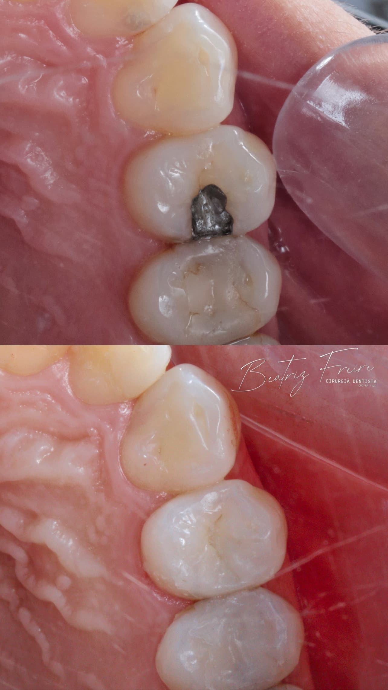 Restauração Estética - Foto 1